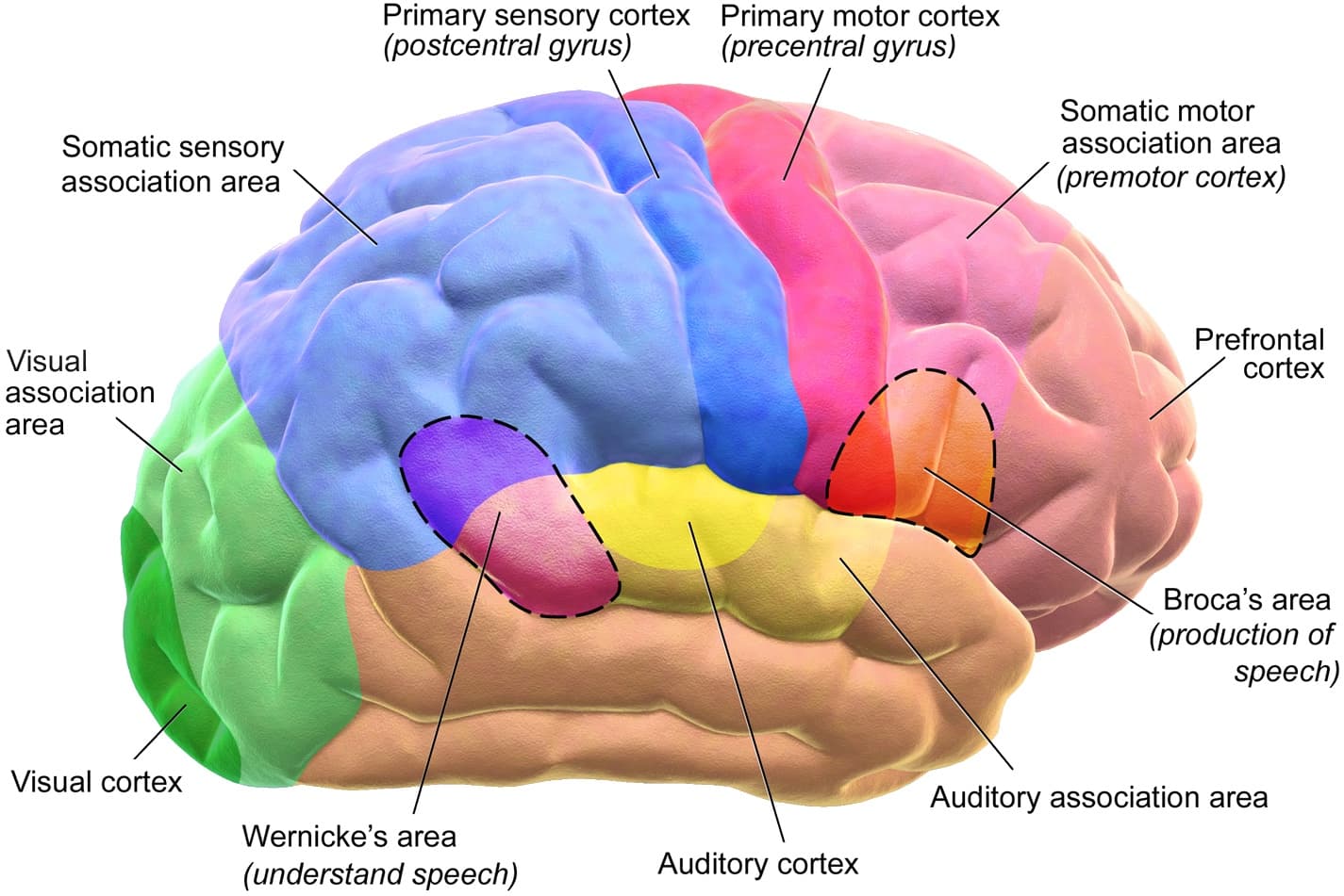 What Is a Traumatic Brain Injury?